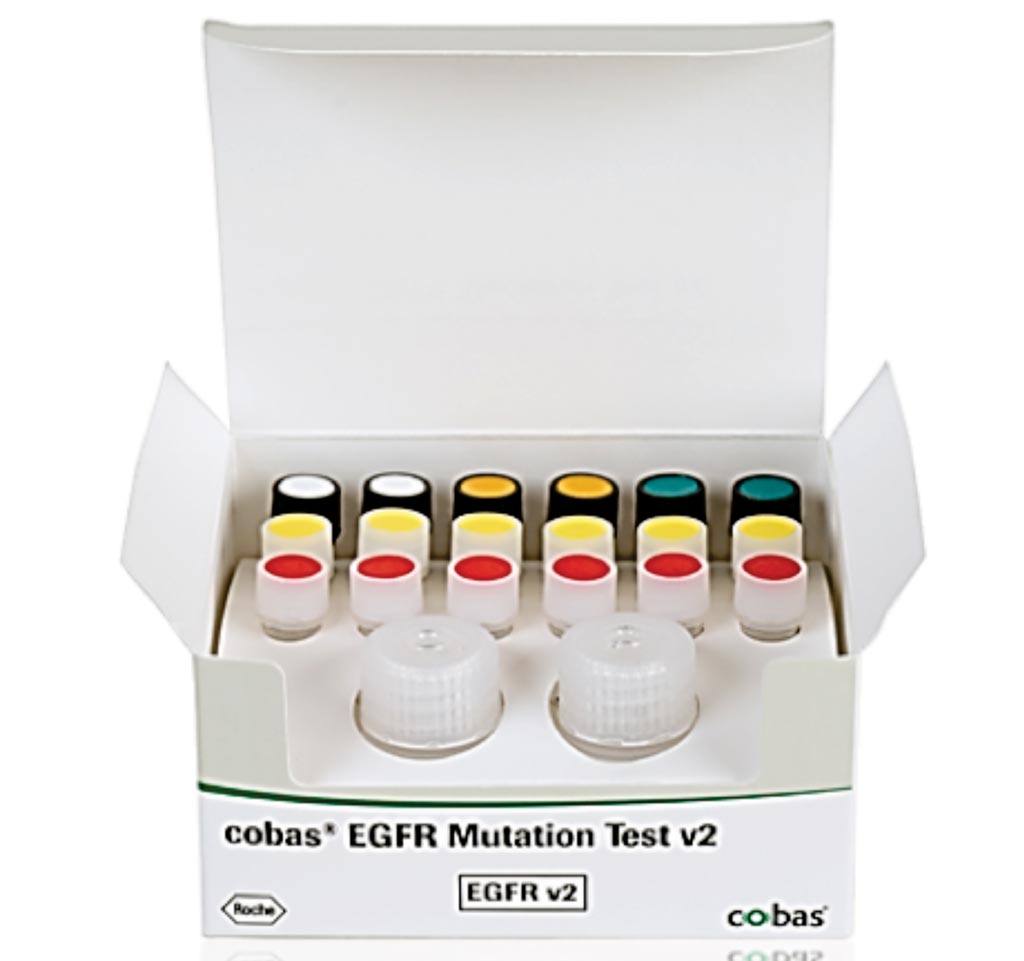 Image: The cobas EGFR Mutation Test v2 CE-IVD identifies the epidermal growth factor receptor (EGFR) gene in the DNA from non-small cell lung cancer (NSCLC) patients (Photo courtesy of Roche Molecular Diagnostics).