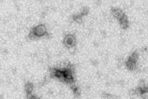 Image: A scanning electron micrograph (SEM) showing the morphology of the bright and round shaped exosomes (Photo courtesy of the University of California, San Diego).