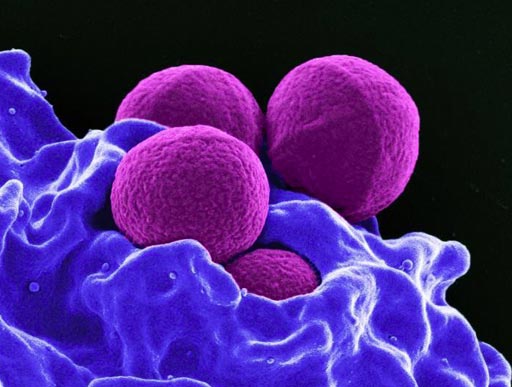 Image: Four spherical S. aureus bacteria being enveloped and destroyed by human white blood cells (Photo courtesy of the U.S. National Institute of Allergy and Infectious Diseases).