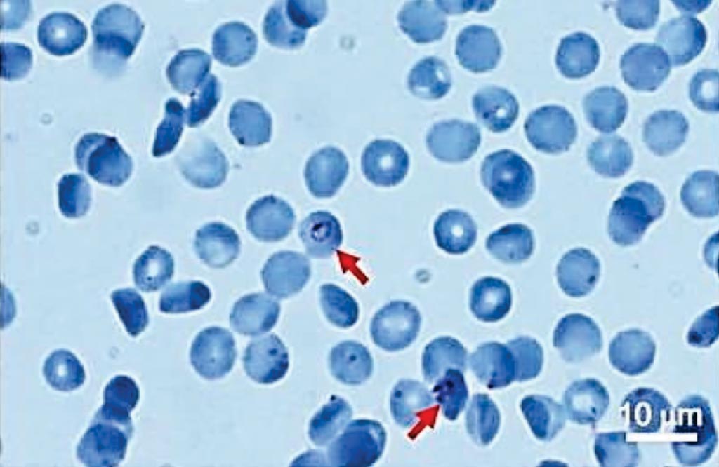 图片：经过吉姆萨染色和亲水处理的COC板的典型图像；箭头表示感染疟原虫的细胞（图片蒙国家先进工业科技研究所惠赐）。
