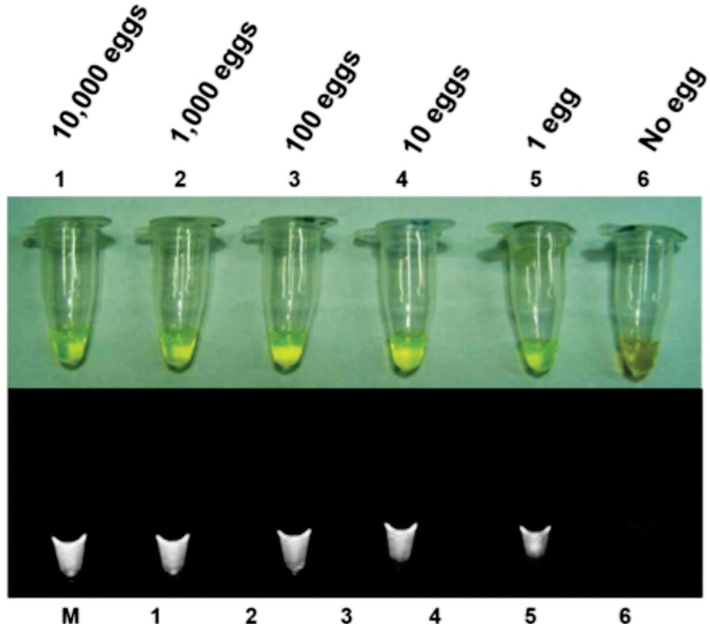 Image: Sensitivity of the loop-mediated isothermal amplification (LAMP) assay for the detection of Clonorchis sinensis eggs in feces experimentally spiked with a known number of eggs in ten-fold serial dilutions from 10,000 eggs (lane 1) to one egg (lane 5) (Photo courtesy of Seoul National University Medical Research Center).