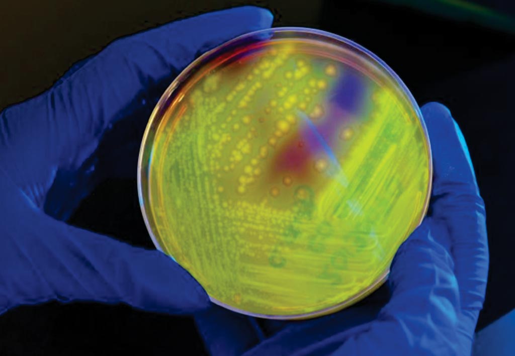 Image: This petri dish culture plate inoculated with Clostridium difficile has been illuminated using long-wave UV irradiation, causing the bacterial colonies to emit a fluorescent glow (Photo courtesy of James Gathany).