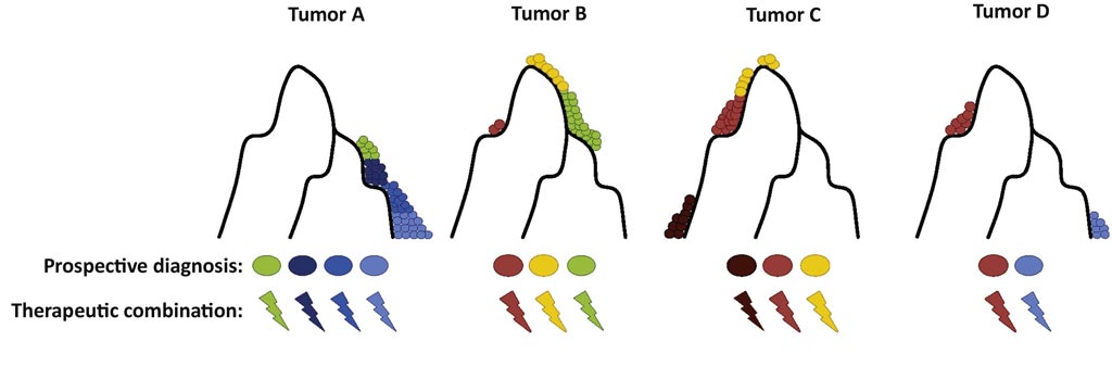 Image: An illustration of individual breast cancer tumors (Tumors A–D) with cells in varying differentiation states (shown in different colors) within a tumor (Image courtesy of Yeo SK and Guan J-L / Trends in Cancer).