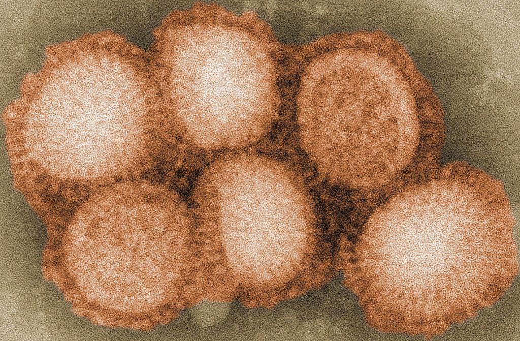 Image: A scanning electron micrograph (SEM) of the influenza virus (Photo courtesy of the CDC).