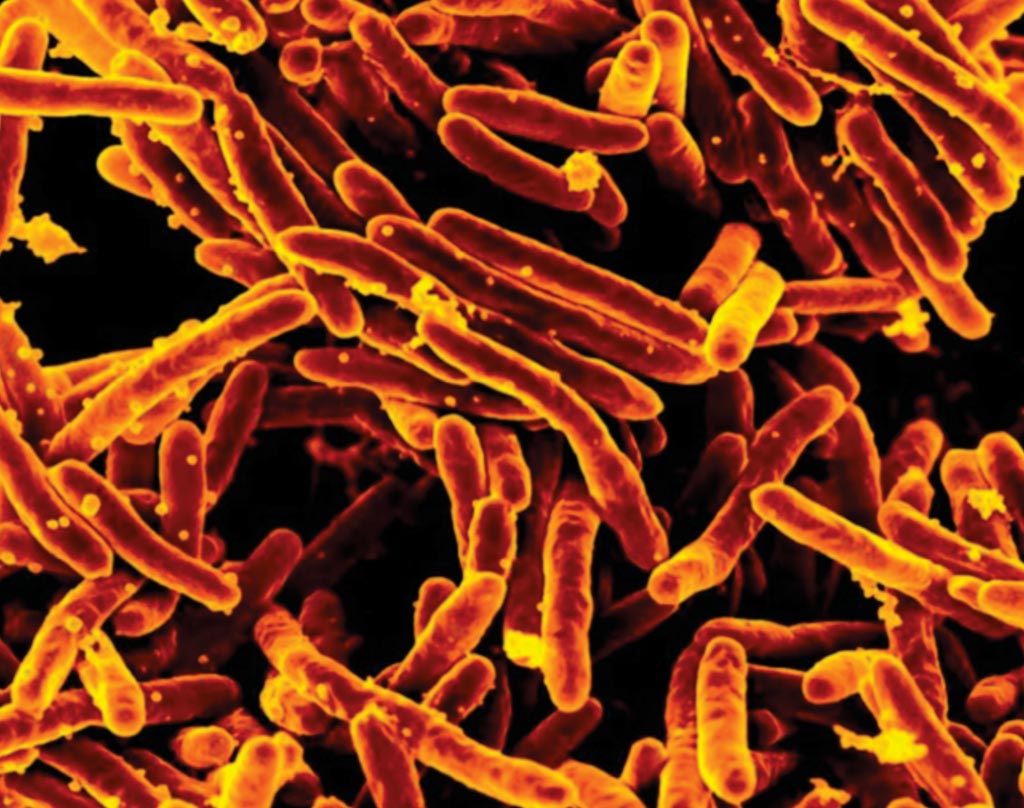 Image: A digitally colorized scanning electron microscopic (SEM) image depicts a large group of orange-colored, rod-shaped Mycobacterium tuberculosis bacteria, which cause tuberculosis (TB) in human beings (Photo courtesy of US National Institute of Allergy and Infectious Diseases).