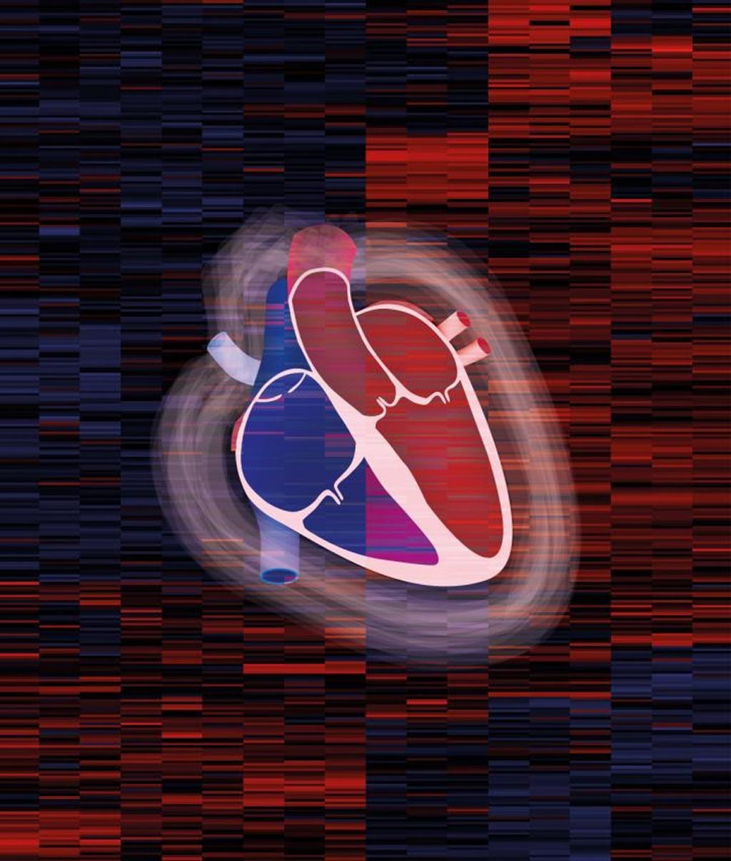Image: Foreground: Drawing of a cardiac muscle. Background: excerpt from a heart map, an overview of the proteins analyzed for the proteomic map (Photo courtesy of Doll, Kraue, Menzfield, Max Planck Institute of Biochemistry).