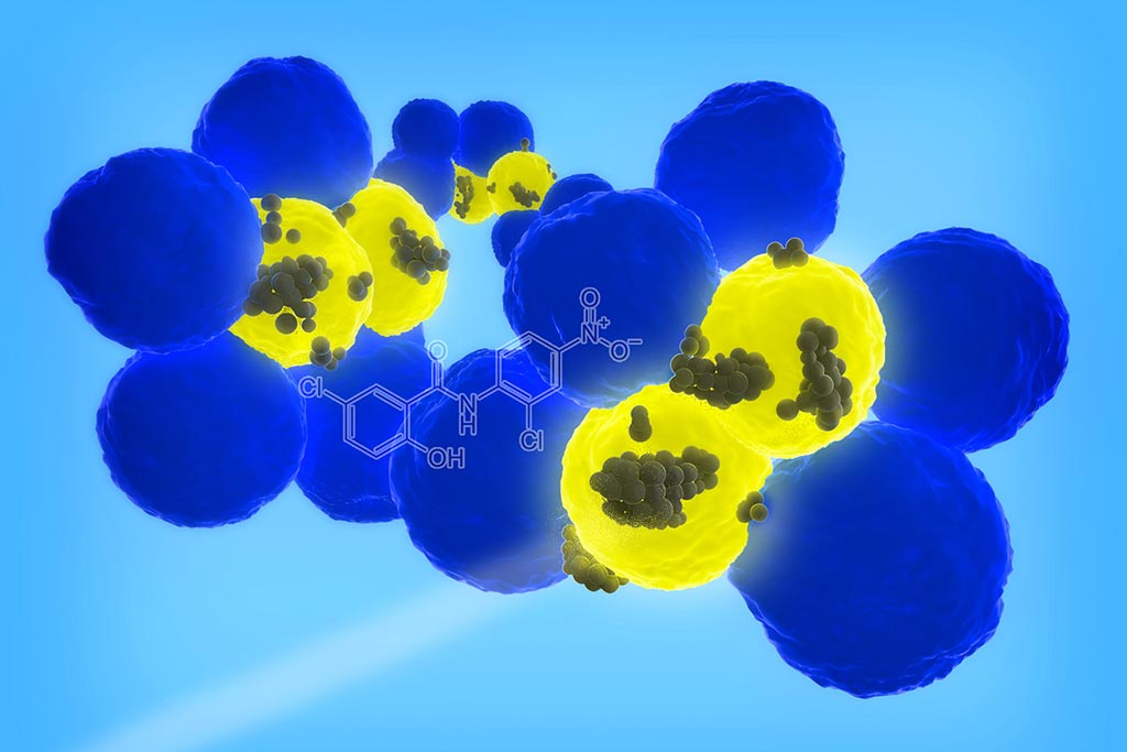 Image: Researchers developed nanoparticles that can target cancer stem cells (yellow), the rare cells within a tumor (blue) that can cause cancer to recur or spread (Photo courtesy of Dr. Dipanjan Pan, University of Illinois).