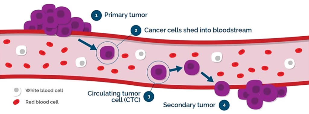 Image: A diagram of circulating tumor cells in the bloodstream (Photo courtesy of Vortex Biosciences).