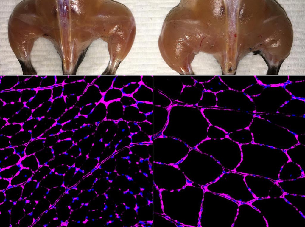 Image: An advanced in vivo Cas9-based epigenetic gene activation system enhances skeletal muscle mass (top) and fiber size growth (bottom) in a treated mouse (right) compared with an independent control (left). The fluorescent microscopy images at bottom show purple staining of the laminin glycoprotein in tibialis anterior muscle fibers (Photo courtesy of the Salk Institute for Biological Research).