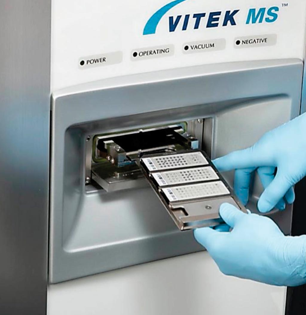 Image: The VITEK MS is an automated microbial identification system that provides identification results in minutes using an innovative mass spectrometry technology — Matrix Assisted Laser Desorption Ionization Time-of-Flight, or MALDI-TOF (Photo courtesy of bioMérieux).
