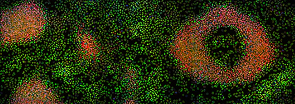 Image: A photomicrograph showing stem cells (red) and differentiating cells (green) (Photo courtesy of Cook Laboratory, University of North Carolina).