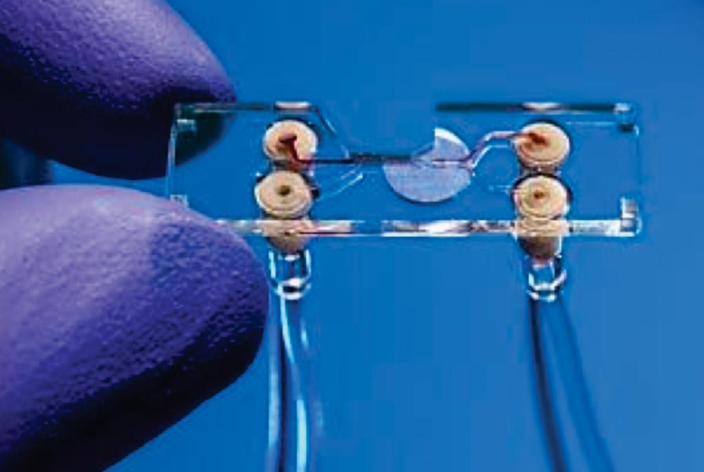 图片：开发的分选芯片用于分析和分离血液样品中的细胞（照片由Fraunhofer Institute of Laser Technology提供）。