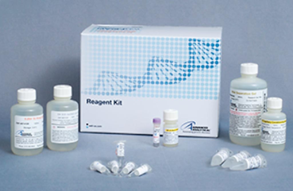 Image: The High Sensitivity Large Fragment Analysis Kit is used for the automated sizing and quantification of large DNA fragments and smears (Photo courtesy of Advanced Analytical Technologies).