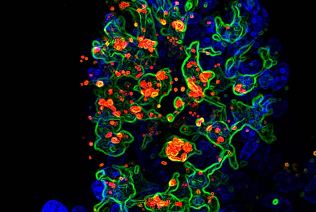 Image: A micrograph showing the opportunistic fungus Candida albicans (red) being engulfed by CX3CR1+ phagocytes (green) in the gut villi (blue) (Photo courtesy of Dr. Iliyan Iliev and Dr. Irina Leonardi, Weill Cornell Medicine).