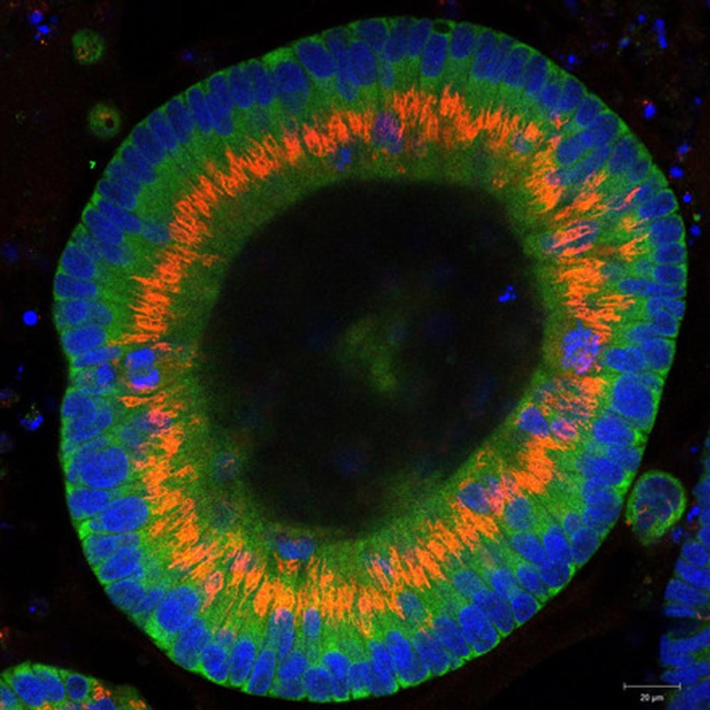 Image: Colon cancer cells grown into three-dimensional organoids in a culture dish (Photo courtesy of Dr. Joseph Regan, Charité - Universitätsmedizin Berlin).