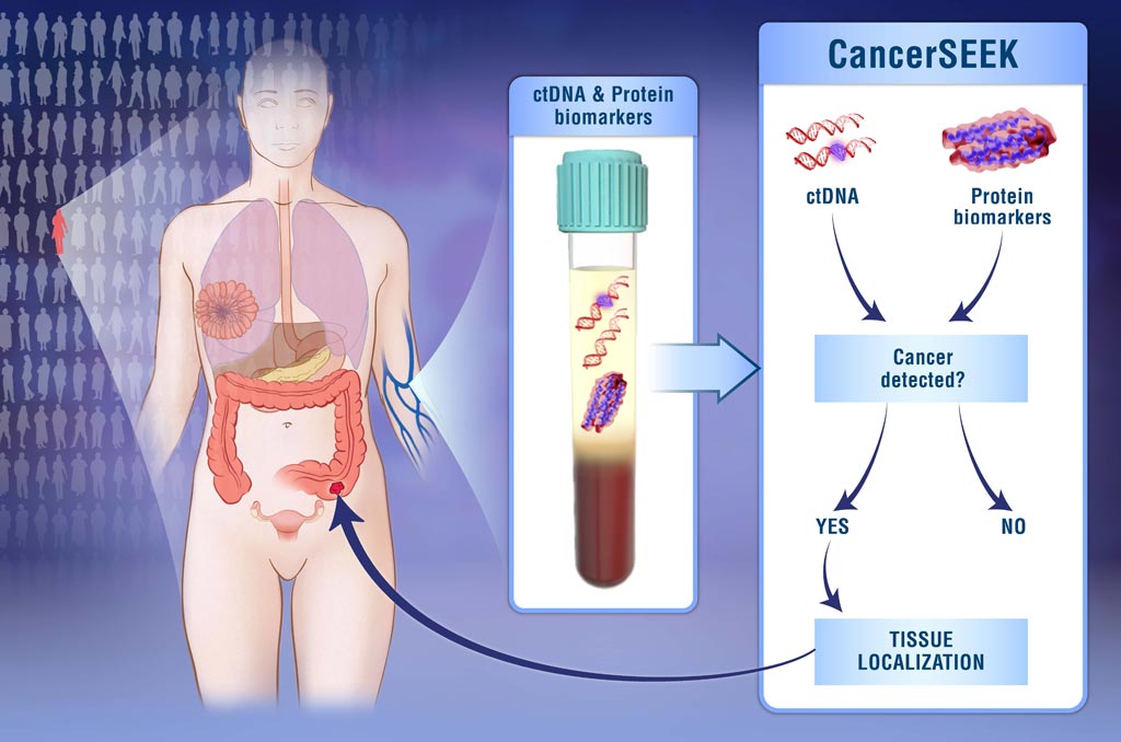 Image: CancerSEEK multi-analyte test simultaneously evaluates levels of eight cancer proteins and the presence of cancer gene mutations from circulating DNA in the blood (Photo courtesy of Elizabeth Cook and Kaitlin Lindsay, Johns Hopkins University).