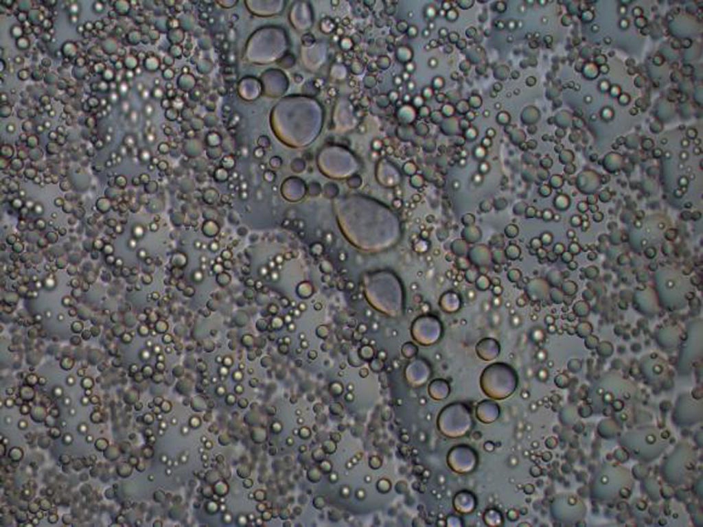 Image: The hnRNPA2 protein forms liquid droplets in a test tube as seen by light microscopy. These structures allow researchers to examine how disease mutations and functional modifications change the behavior of the proteins with atomistic detail (Photo courtesy of Veronica Ryan, Brown University).