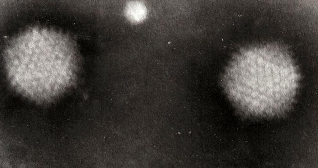 Image: Transmission electron micrograph (TEM) of two oncolytic adenovirus particles of the type modified to target pancreatic cancer cells (Photo courtesy of Wikimedia Commons).