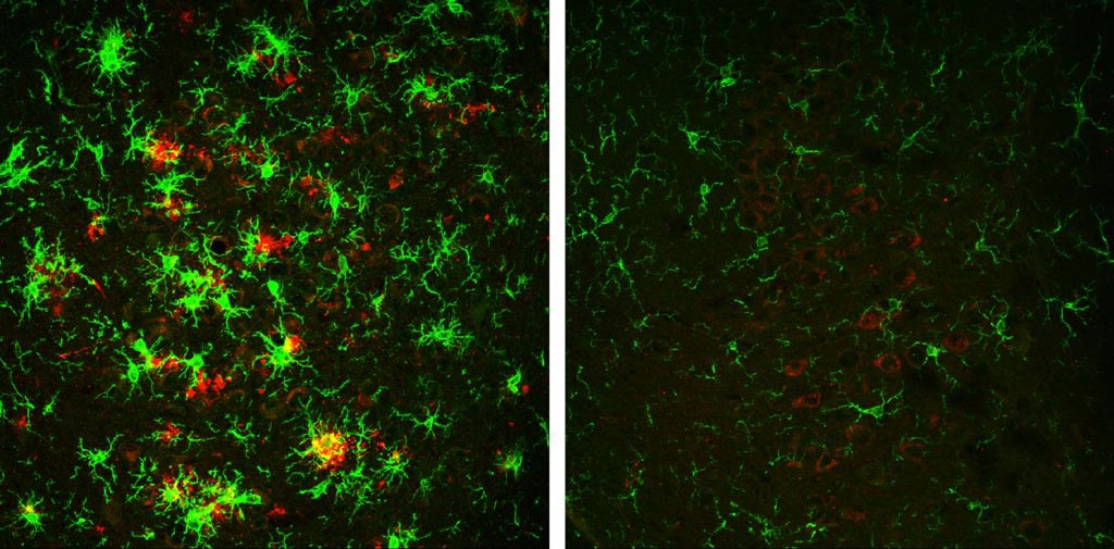 Image: The brain of a 10-month-old mouse with Alzheimer\'s disease (left) is full of amyloid plaques (red) surrounded by activated microglial cells (green). But these hallmarks of Alzheimer\'s disease are reversed in animals that have gradually lost the BACE1 enzyme (right) (Photo courtesy of The Cleveland Clinic and Rockefeller University Press).