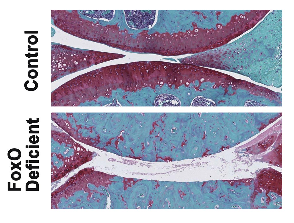 Image: Knee joints from control and FoxO deficient mice. The areas in red are joint cartilage, which is destroyed in FoxO deficient mice after treadmill running (Photo courtesy of the Lotz Laboratory, The Scripps Research Institute).