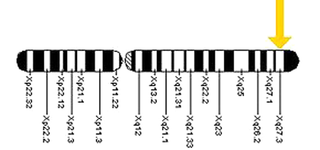 Image: The location of the FMR1 gene on the X chromosome (Photo courtesy of Wikimedia Commons).
