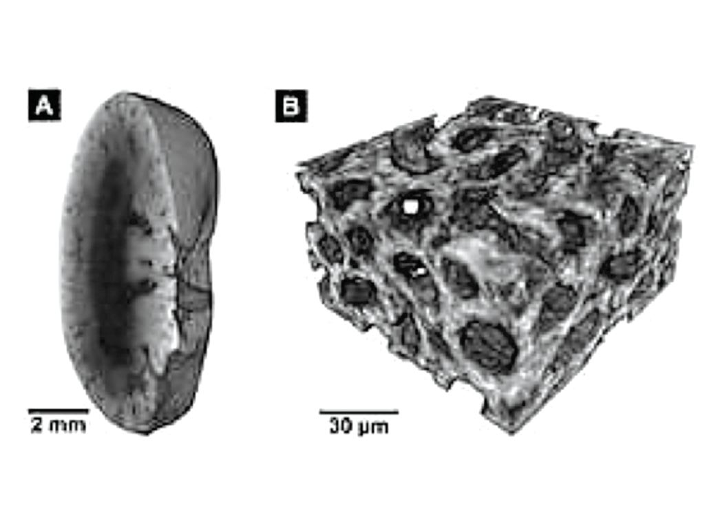 Image: These were created using the new staining method: A: Micro-CT image of a mouse kidney, B: Nano-CT image of the same tissue (Photo courtesy of the Technical University of Munich).