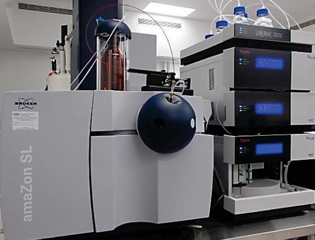 Image: Liquid chromatography-mass spectrometry used for targeted profiling of plasma metabolites (Photo courtesy of McGill University).