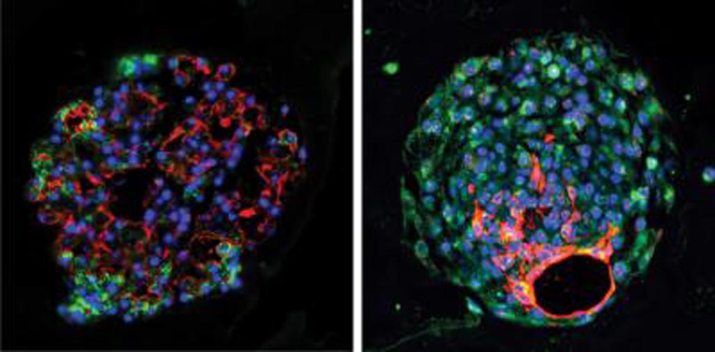 Image: Mouse (left) and human (right) alveolar progenitor cells grow into large lung organoids in culture, and make multiple types of epithelial cells including gas exchange type 1 cells (red) and surfactant-producing type 2 cells (green) (Photo courtesy of the Morrisey Laboratory, University of Pennsylvania).