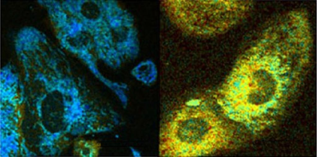 Image: An optical readout of bound NADH fraction in control (left), and carbonyl cyanide m-chlorophenyl hydrazine treated (right) HL-1 cardiomyocytes (Photo courtesy of Irene Georgakoudi and Zhiyi Liu, Tufts University).