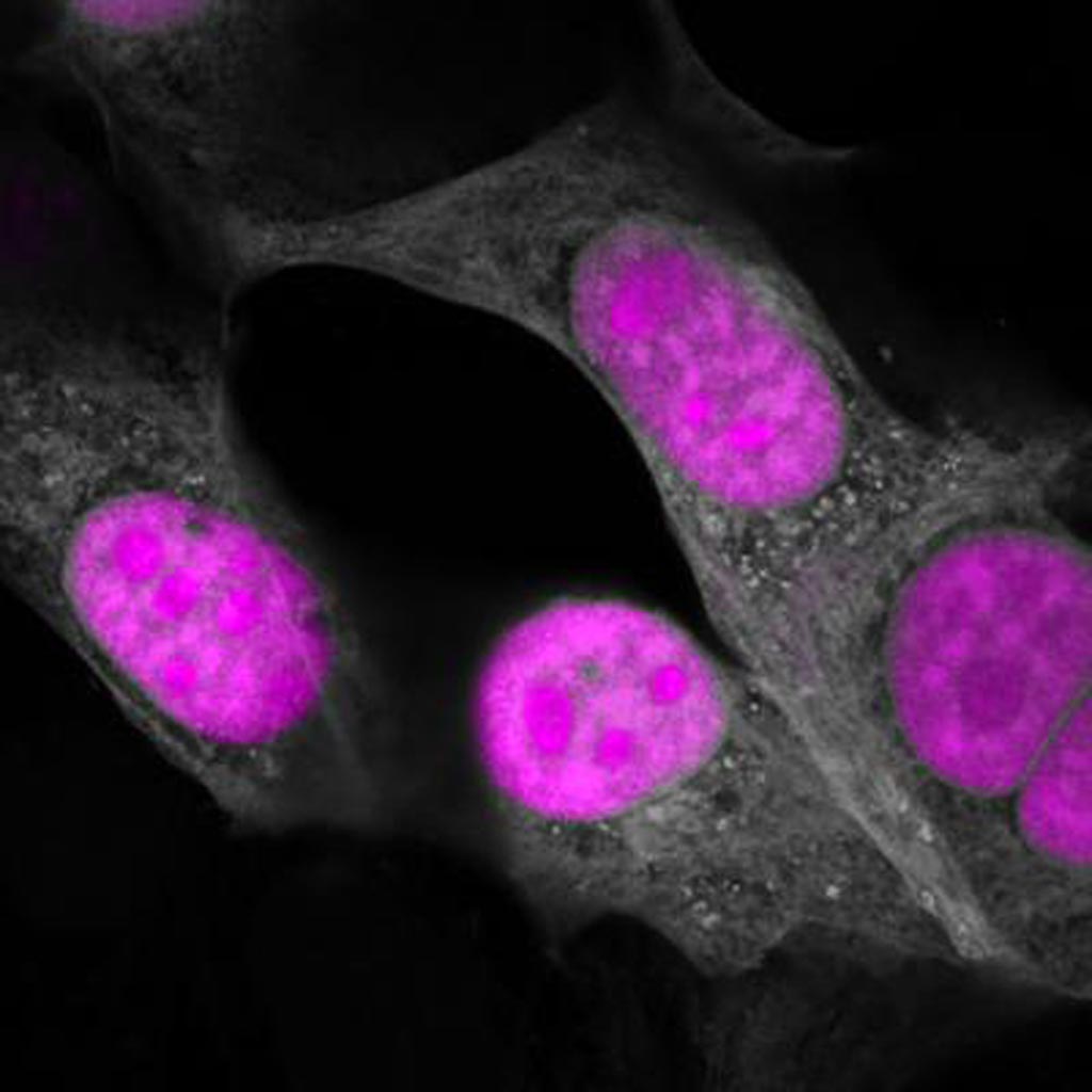 Image: CasRx (magenta) targeting RNA in the nucleus of human cells (gray) (Photo courtesy of the Salk Institute for Biological Research).