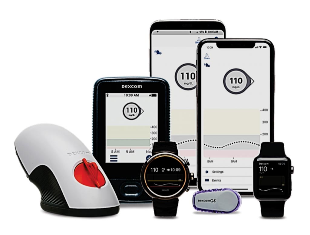 Image: The Dexcom 6 is an integrated continuous glucose monitoring (iCGM) system for determining blood glucose (Photo courtesy of DEXCOM).