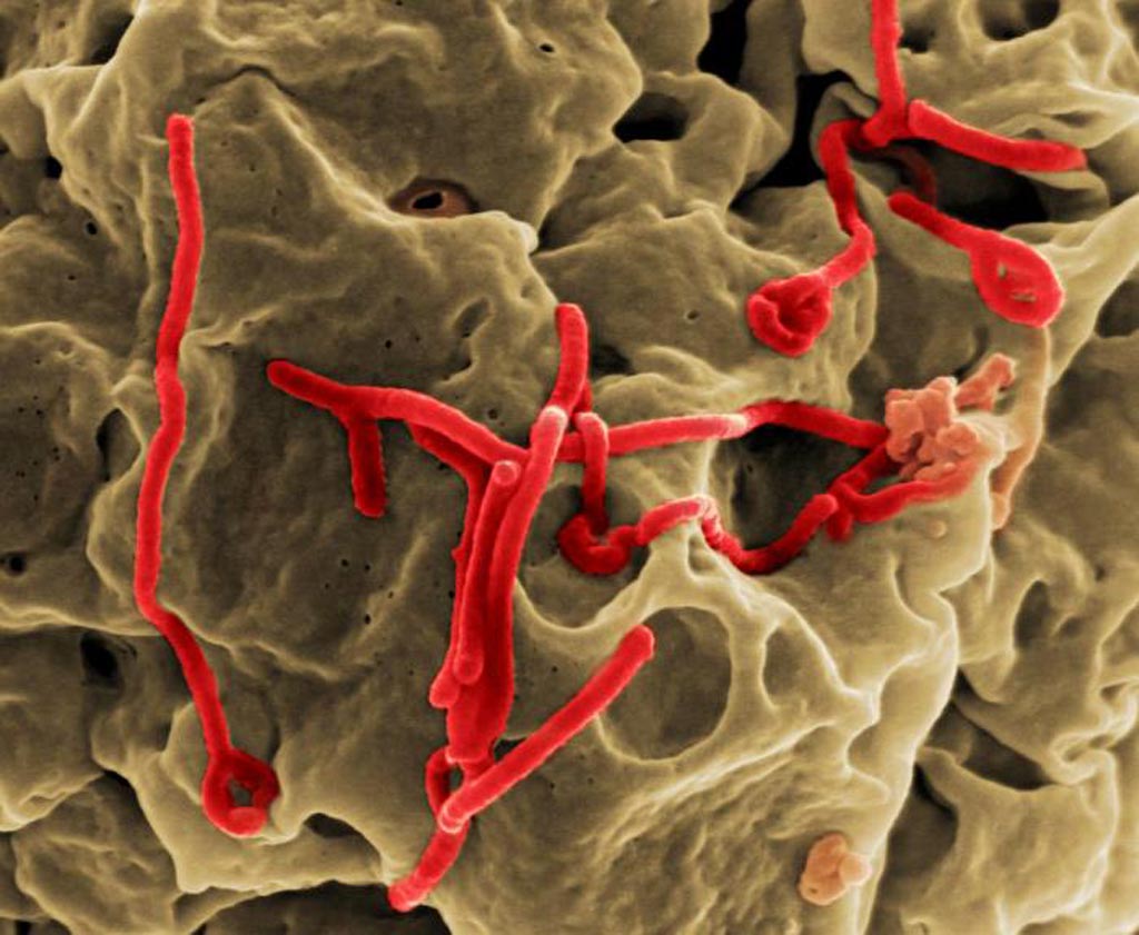 Image: Under a very-high magnification, this digitally colorized scanning electron micrograph (SEM) depicts a number of filamentous Ebola virus particles (red) that had budded from the surface of a VERO cell (brown) of the African green monkey kidney epithelial cell line (Photo courtesy of the [U.S.] National Institute of Allergy and Infectious Diseases).