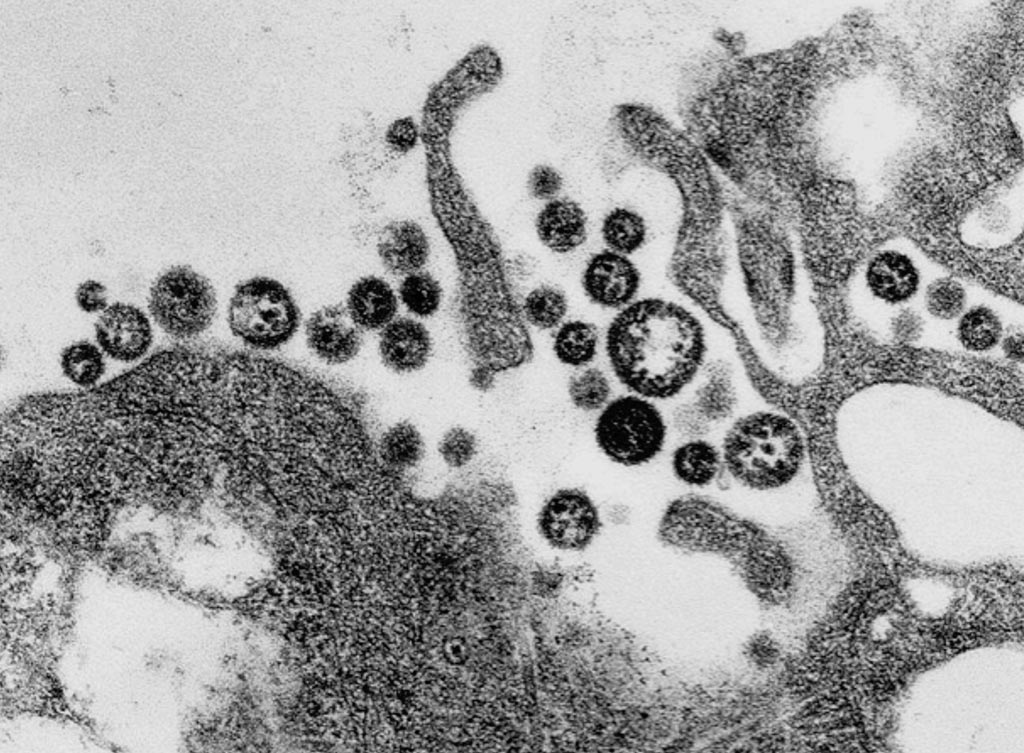 Image: A transmission electron micrograph (TEM) of a number of Lassa virus virions adjacent to some cell debris (Photo courtesy of C. S. Goldsmith/CDC).