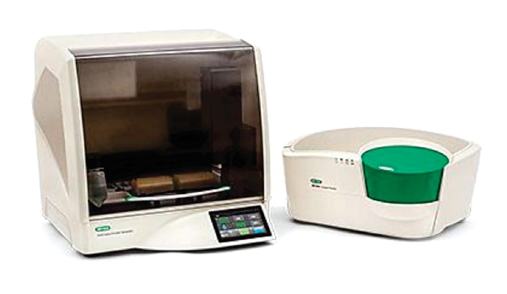 Image: The QX200 AutoDG Droplet Digital PCR System provides absolute quantification of target DNA or RNA molecules for EvaGreen and probe-based ddPCR applications (Photo courtesy of Bio-Rad).