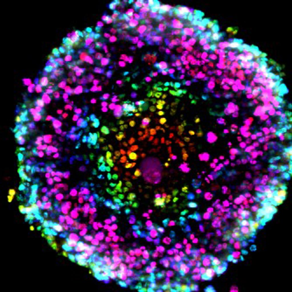 Image: A micrograph of a pancreatic cancer spheroid culture (Photo courtesy of Dr. Shurong Hou, Scripps Research Institute).