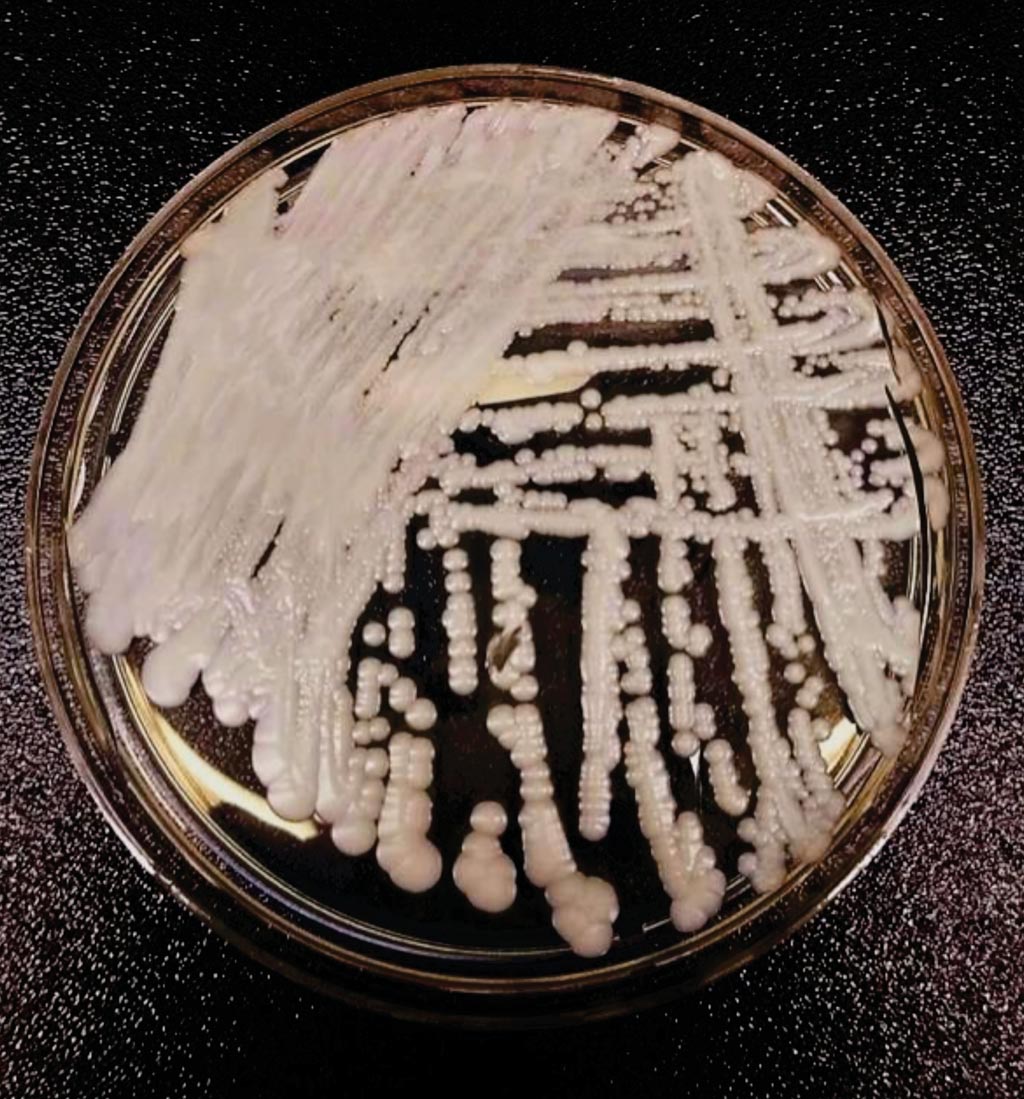Image: A strain of Candida auris cultured in a petri dish. C. auris is difficult to identify with standard laboratory methods, and can be misidentified in laboratories without specific technology (Photo courtesy of the CDC).