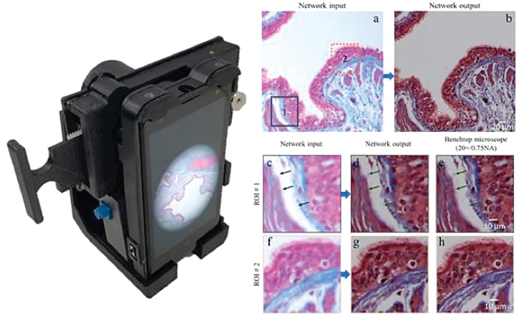 Распечатанные на 3D-принтере устройства могут захватывать микроскопические изображения, будучи прикрепленными к объективу камеры смартфона (фото любезно предоставлено Ozcan Research Group/UCLA).