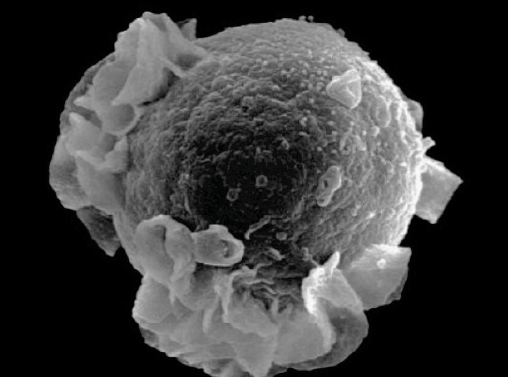 Image: An Epstein-Barr virus budding in a B cell (Photo courtesy of Kenyon College).