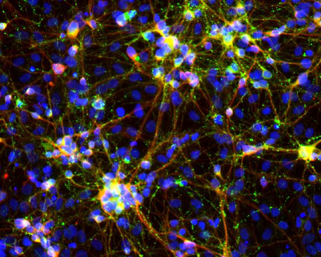 Image: Human induced neurons generated from a novel transcription factor pair. Colors represent a nuclear stain (DAPI) in blue, synaptic marker expression (Synapsin1) in green, and neuron-specific beta-III tubulin expression (Tuj1) in red (Photo courtesy of Dr. Kristin Baldwin, The Scripps Research Institute).