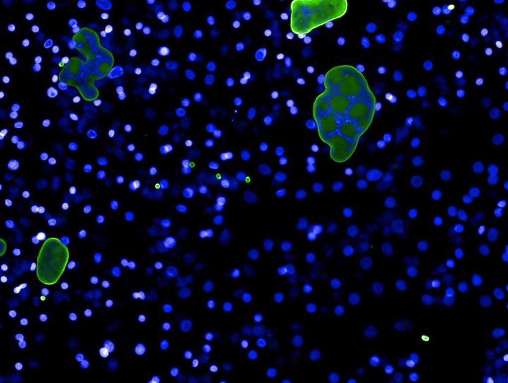 Image: The large green structures are the P. vivax parasites surrounded by human liver cells (Photo courtesy of Dr. John Adams, University of South Florida).