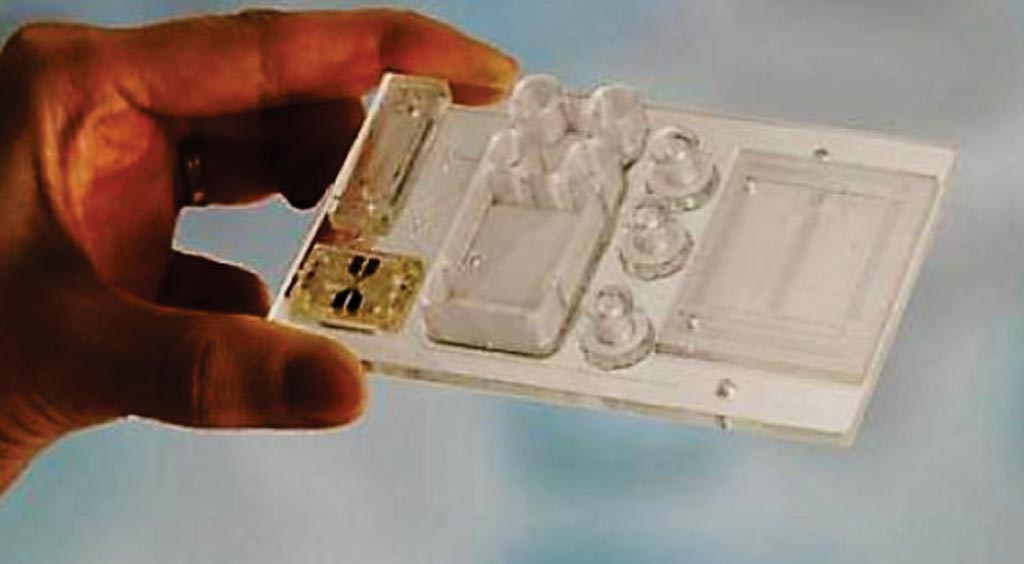 Маленький пластиковый чип размером с кредитную карту может предоставить такую же диагностическую информацию, что и биопсия костного мозга, однако использует вместо этого образец крови (фото любезно предоставлено Канзасским университетом).