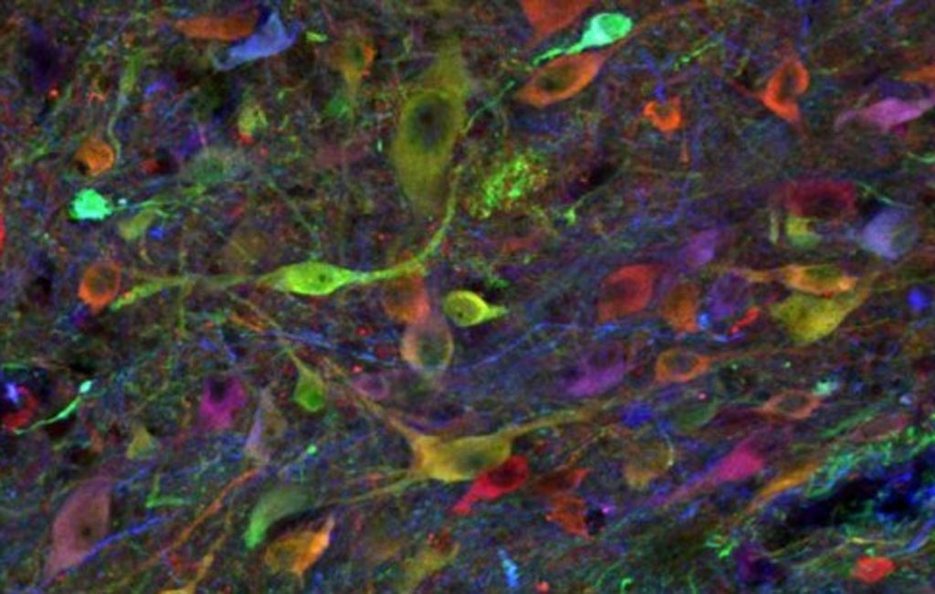 Image: A population of induced pluripotent stem cell-derived neurons in an allogenic, previously injured spinal cord of a pig at three-and-a-half months (Photo courtesy of the University of California, San Diego).