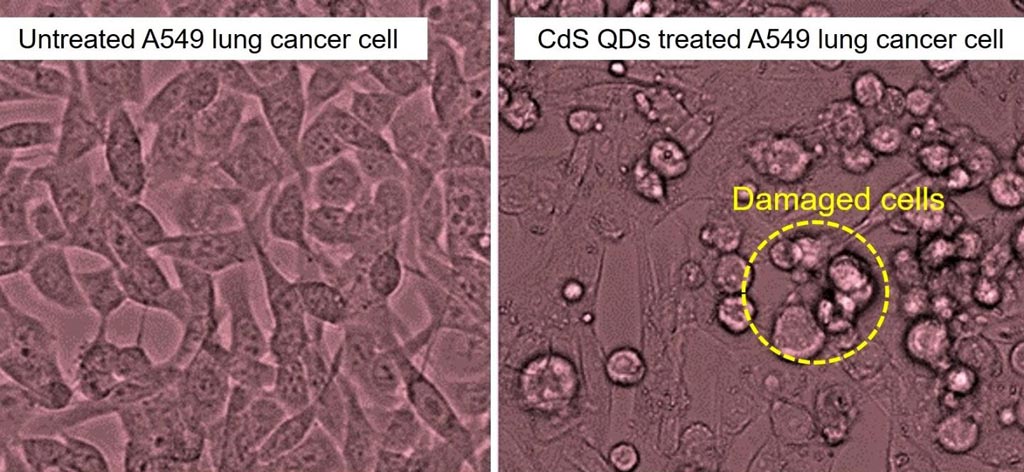 Image: Photomicrographs of A549 lung cancer cells; left = untreated; right = treated with quantum dots (Photo courtesy of Swansea University).