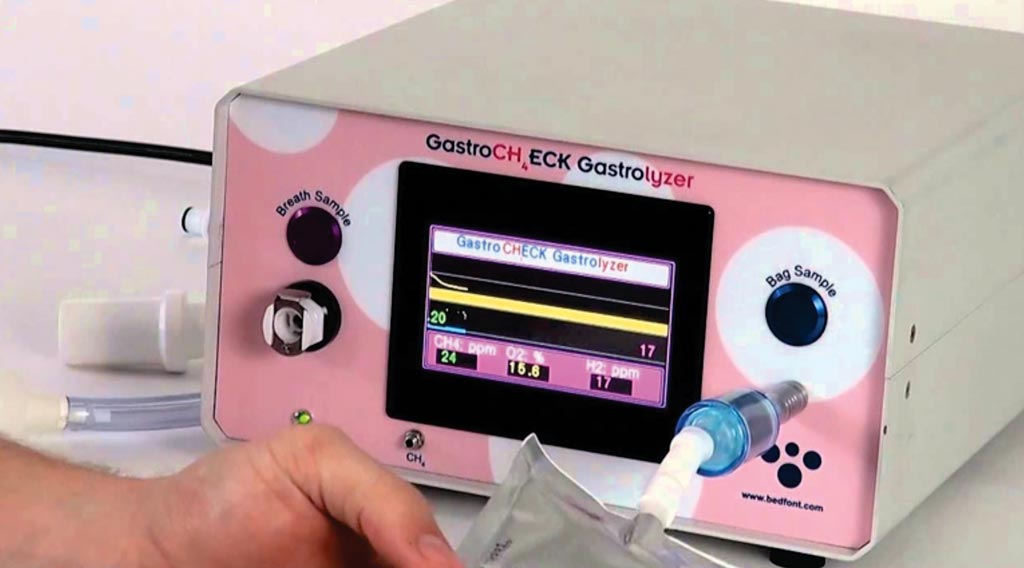 Image: The GastroCHECK Gastrolyzer breath test monitor (Photo courtesy of coVita).