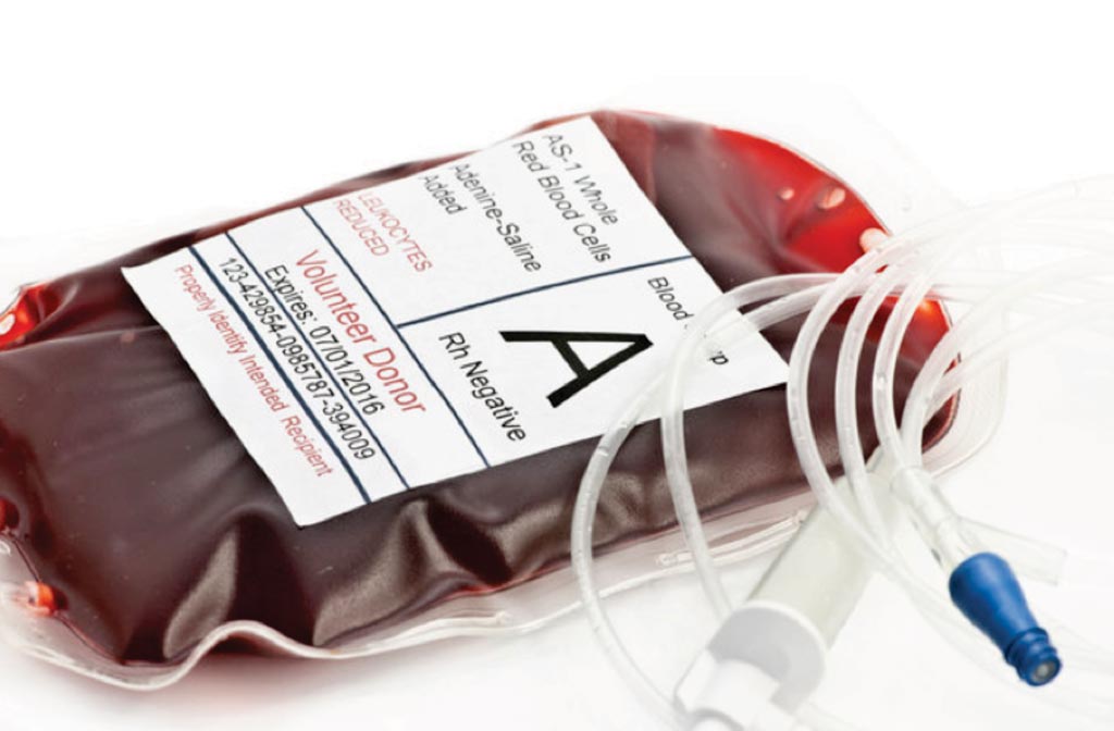 Image: A blood transfusion bag typed for A Rh negative (Photo courtesy of Sherry Yates Young).