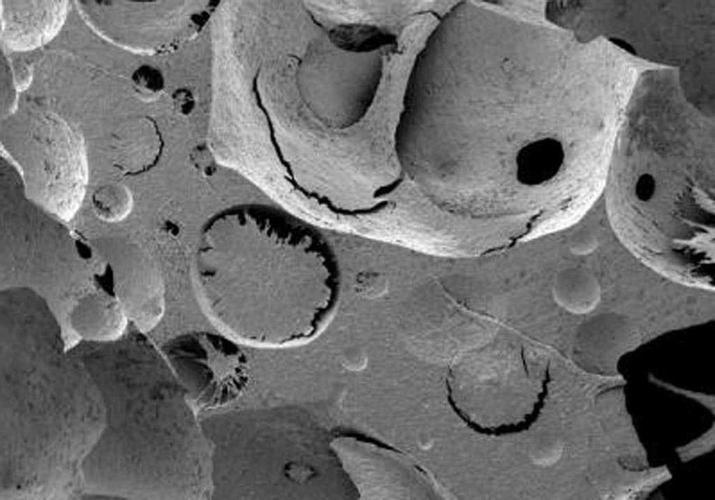 Image: A scanning electron microscopy (SEM) images confirm the deposition of an extracellular matrix, which embeds cells, presumably of both stromal and blood origins (Photo courtesy of the University of Basel).