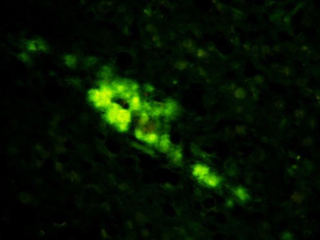 Image: Synthetic human prions accumulating in the brain of humanized transgenic mice (Photo courtesy of Case Western Reserve University School of Medicine).