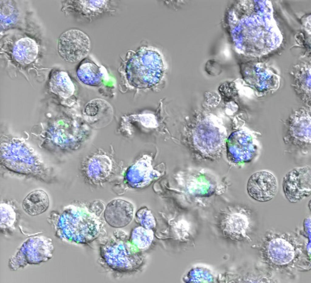 Image: Immune cells that ingested spider silk nanoparticles (in green). The endosomes – the part of the cell in which the nanoparticles release the vaccine – appear in blue (Photo courtesy of Bourquin Laboratory, University of Geneva).