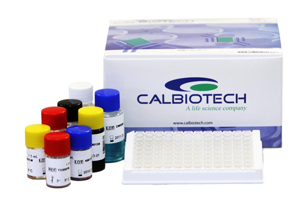 Image: The new line of ELISA tests designed for neonatal screening is based on Dry Blood Spot (DBS) technology and comprises a menu of eight kits (Photo courtesy of Calbiotech).
