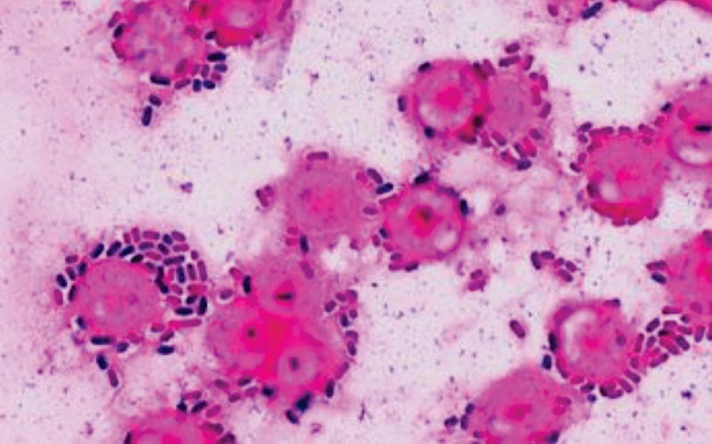 Image: A gram stain of Klebsiella pneumoniae from a blood culture (Photo courtesy of Erasmus Medical Centre).